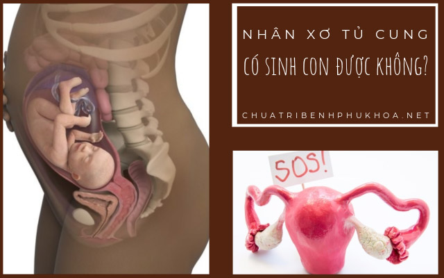 nhân xơ tử cung có mang thai được không