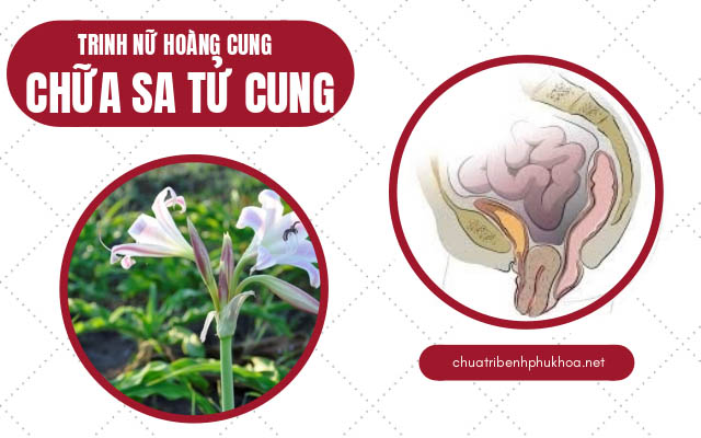 chữa da tử cung bằng trinh nữ hoàng cung