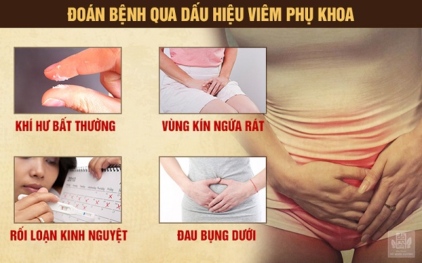 Những dấu hiệu điển hình của bệnh viêm phụ khoa